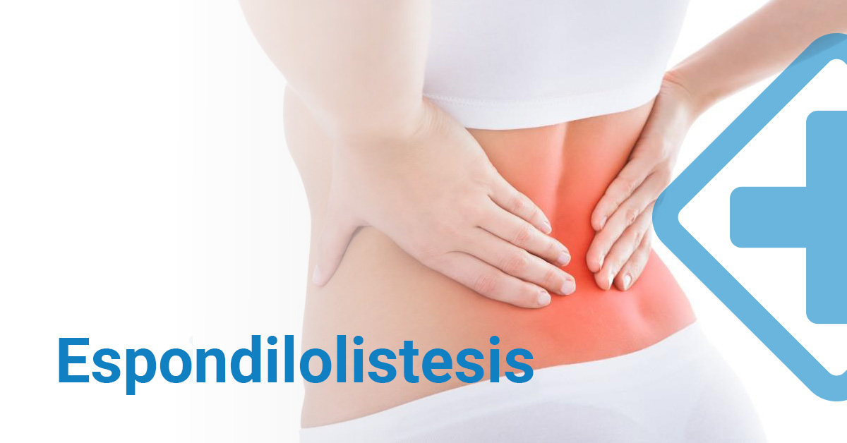 Cifosis o Enfermedad de Scheuermann